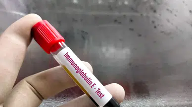 Ankara Alerji Testi Nerede Yapılır?